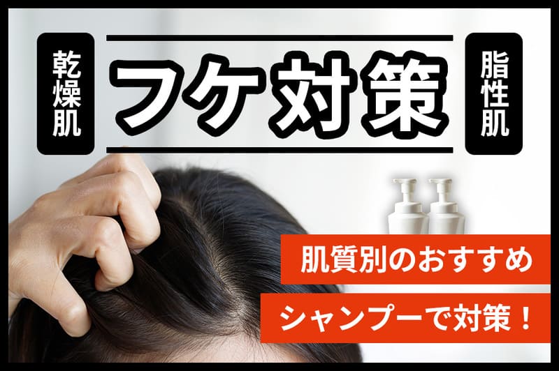 フケ対策シャンプーおすすめ人気20選【2026年10月】乾燥・脂性別の対策アイテムを紹介